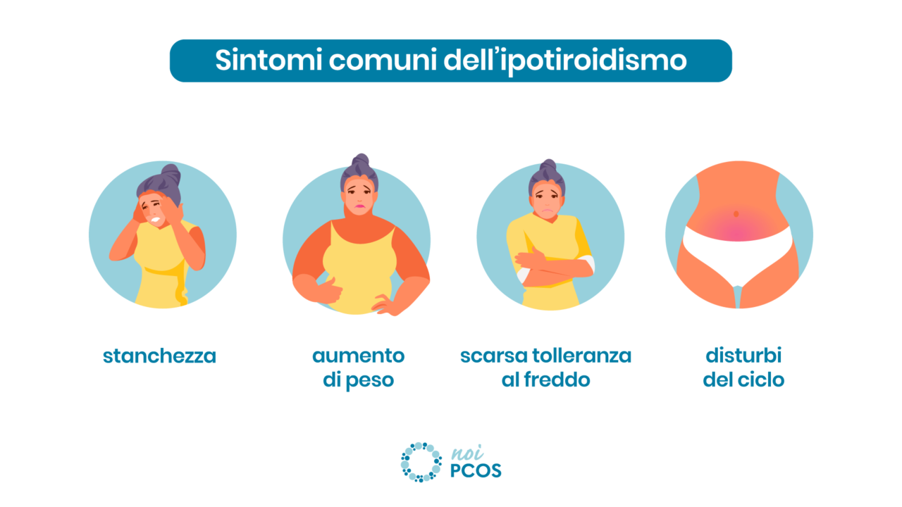 Ovaio policistico e ipotiroidismo se la tiroide è pigra Noi PCOS