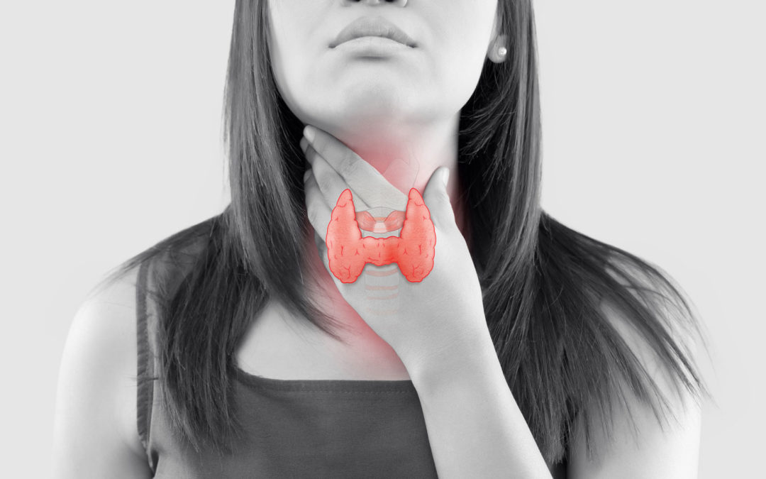 Ipotiroidismo e PCOS: se la tiroide è pigra