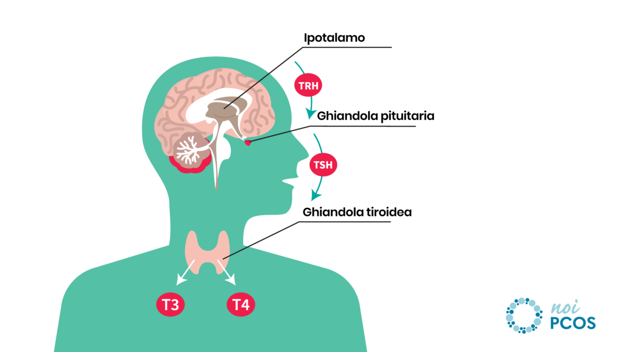 Ipotiroidismo Congenito Si Puo Guarire
