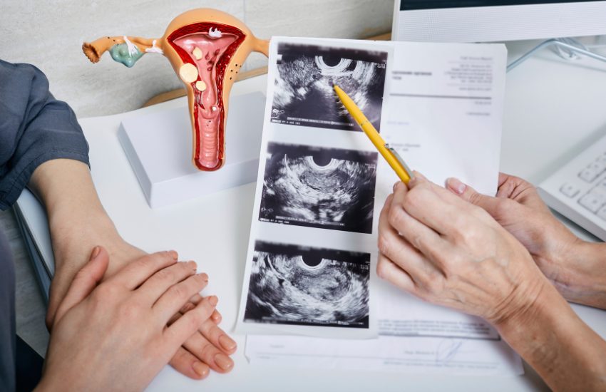 Trattamenti laser e a microonde: nuove frontiere nella gestione della PCOS?